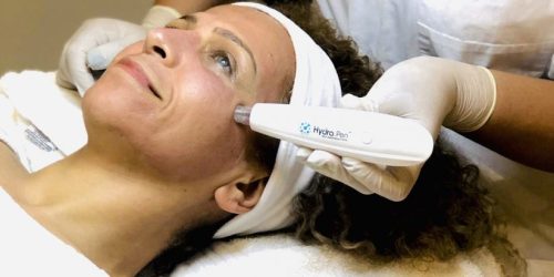 Hydraneedling-Behandlung-1-823x420-1